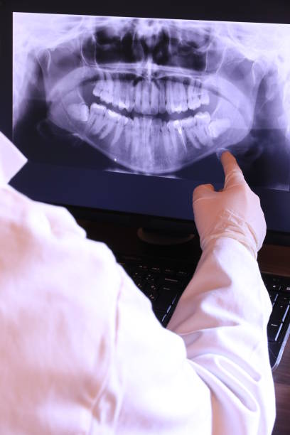Best Emergency Tooth Extraction in Pennville, PA